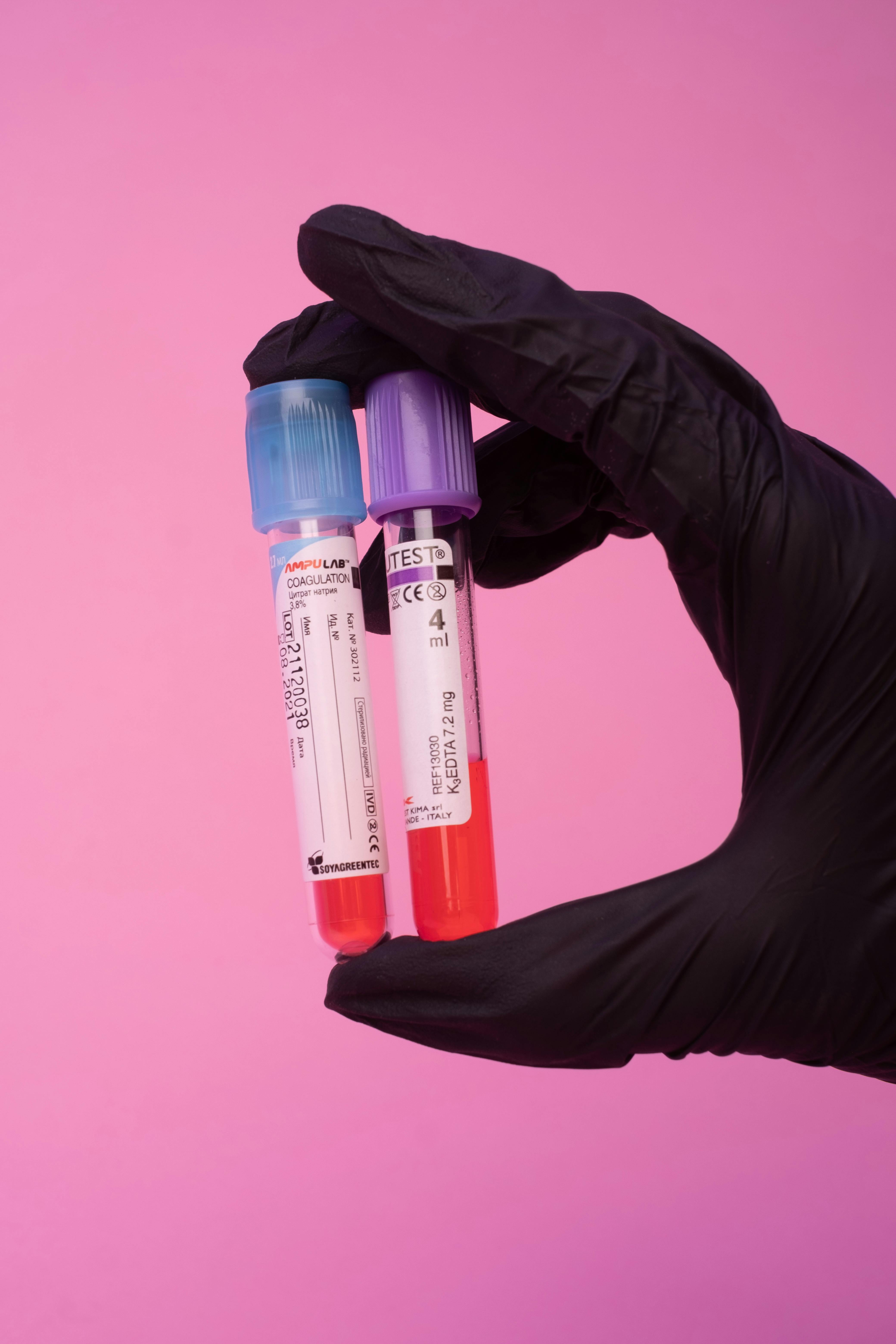 Konsultacje Hematologiczne w CM Femmemedica Kraków – Diagnostyka i Leczenie Chorób Krwi